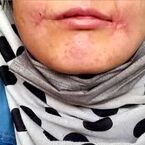 مرد معتاد لب‌های زن ۱۸ ساله‌اش را دوخت| اظهارات تکان‌دهنده فائزه در کلانتری خواجه‌ربیع مشهد
