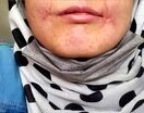 مرد معتاد لب‌های زن ۱۸ ساله‌اش را دوخت| اظهارات تکان‌دهنده فائزه در کلانتری خواجه‌ربیع مشهد