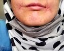 مرد معتاد لب‌های زن ۱۸ ساله‌اش را دوخت| اظهارات تکان‌دهنده فائزه در کلانتری خواجه‌ربیع مشهد