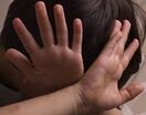 پدر سنگدل، فرزند ۱۸ ساله معلولش را به آتش کشید
