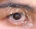 خشکی چشم ممکن است عامل ابتلا به کدام بیماری شود؟