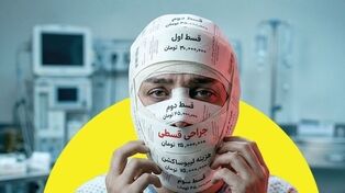 زیبایی قسطی | پرداخت قسط جراحی بینی به جای تأمین مایحتاج ضروری!