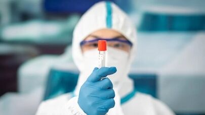 متخصصان درباره طاعون ریوی چه می‌گویند؟