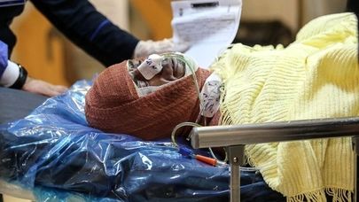 گام‌های حیاتی در درمان سوختگی‌های شدید در شرایط جنگی و انفجار