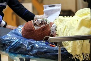 گام‌های حیاتی در درمان سوختگی‌های شدید در شرایط جنگی و انفجار